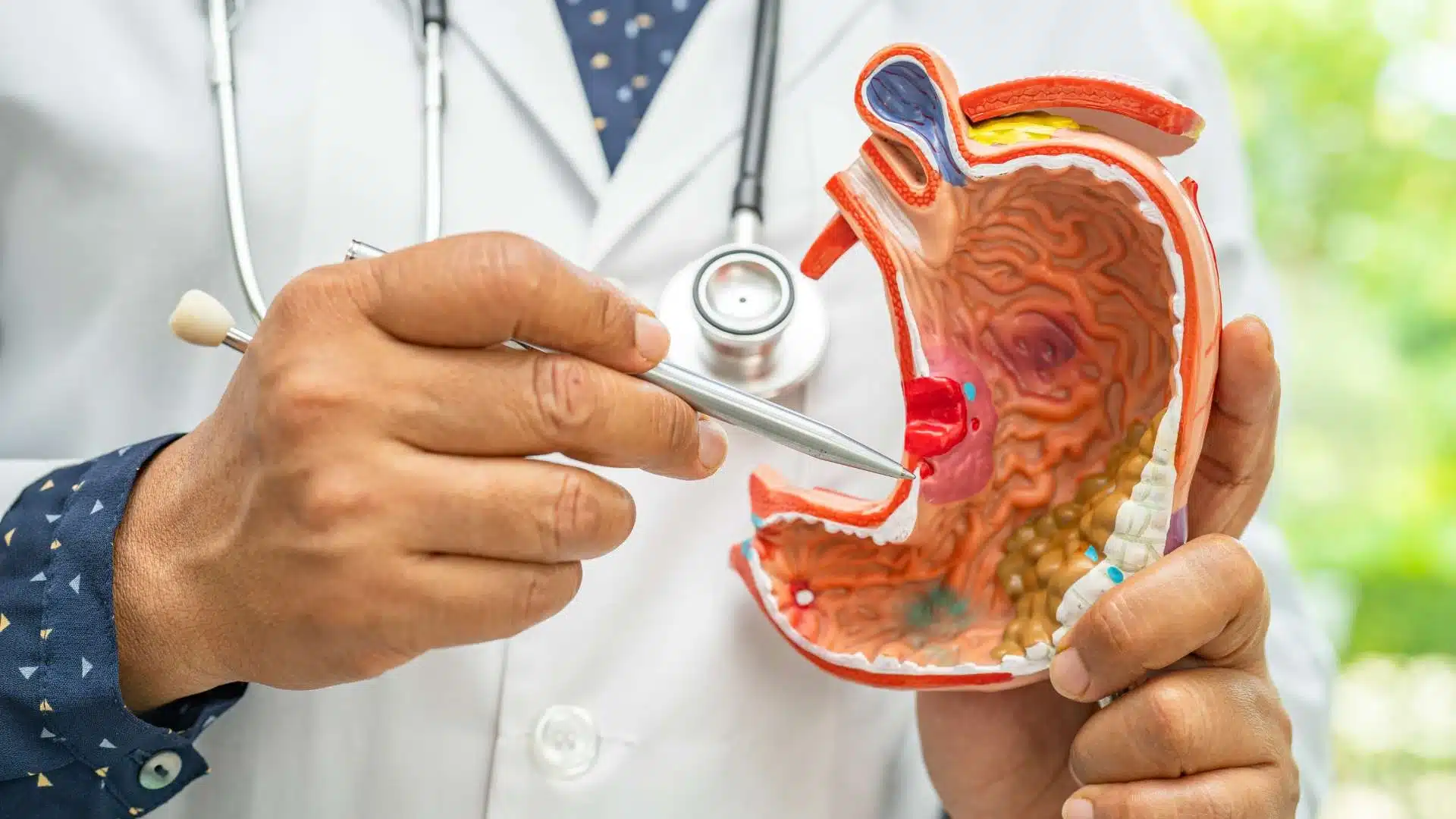 Câncer de estômago | Dr. Arthur Arrais | Gastroenterologista