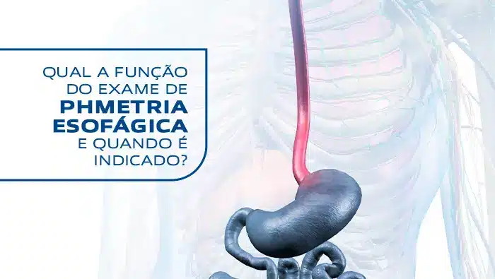 Qual a função do exame de phmetria esofágica | Dr. Arthur Arrais | Gastroenterologista